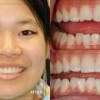 Dr Aaron Johnson http://www.johnson-dental.com/