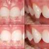 Dentists in Northfield MN http://www.johnson-dental.com/