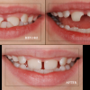 Dentists in Minnesota http://www.johnson-dental.com/